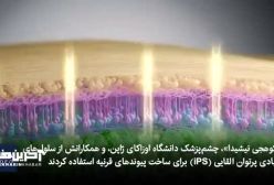 بازگشت بینایی با پیوند سلول های بنیادی